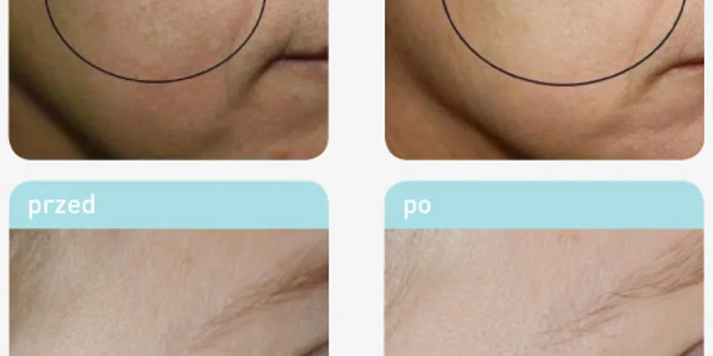 Pracownia Urody Gdańsk 8